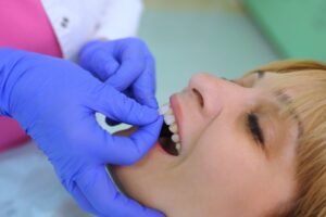 Young woman having veneer fitted onto her teeth.